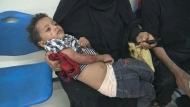 27مدنيا ضحايا مجازر بشعة للمليشيات بتعز و45قتيلا وجريحا من مسلحيها بمعارك التشريفات