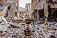 النزاع في اليمن.. العيون لا تكذب أبداً