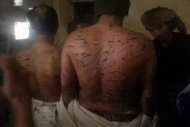 منظمات تحذر من تعرض حياة 5 معتقلين للخطر داخل السجن الحربي بصنعاء