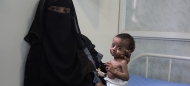 اليونيسيف: تسع سنوات من النزاع في اليمن خلفت ملايين الأطفال المصابين بسوء التغذية والتقزم
