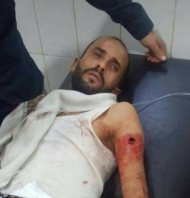 نجاة الحالمي من محاولة اغتيال بالضالع وتجدد المعارك في مريس