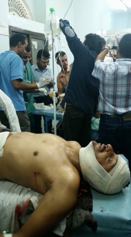  احد الضحايا من المدنيين جراء قصف المليشيات على احياء تعز